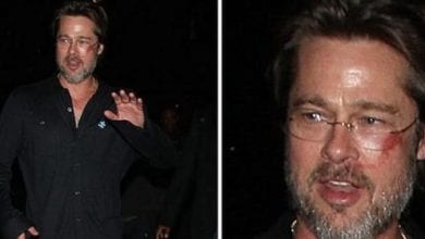 Brad Pitt e quei lividi sulla faccia: cos'è successo?