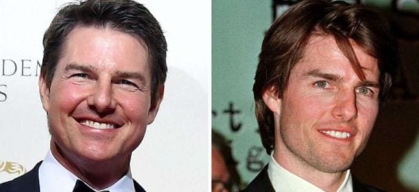 Tom Cruise ha ceduto al fascino del ritocchino?