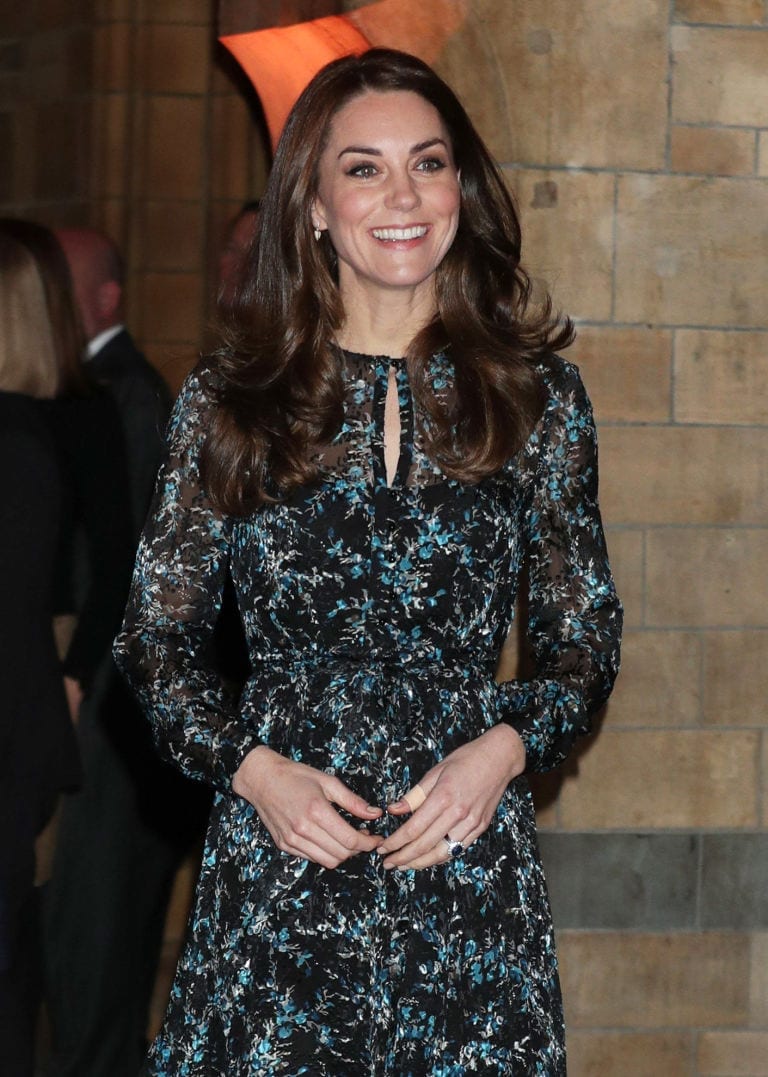 Kate Middleton: il mistero dei cerotti sulle mani