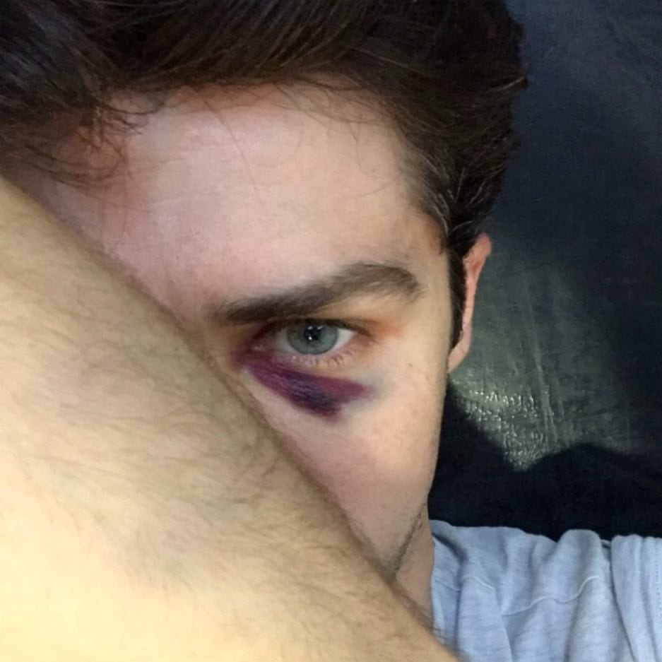 Roberto Bolle incidente: "Chi l'ha detto che il balletto non è pericoloso?" [FOTO+VIDEO]