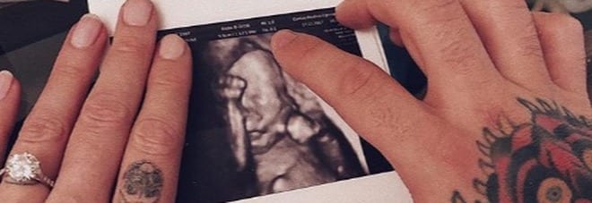 Chiara Ferragni e Fedez: ecografia sui social e il web risponde