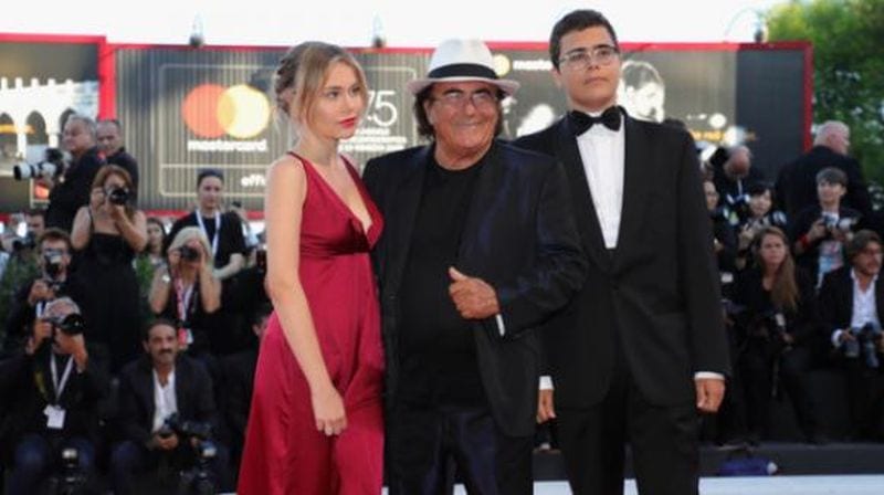 Jasmine Carrisi rifatta? Le foto prima e dopo che faranno male a papà Al Bano