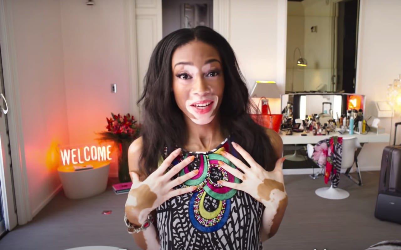 Winnie Harlow